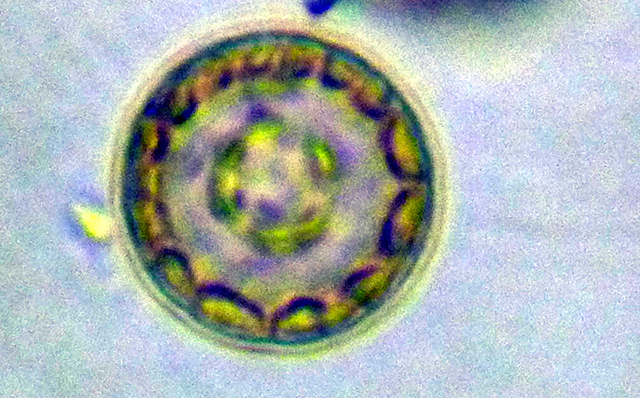 硅藻門--小環藻